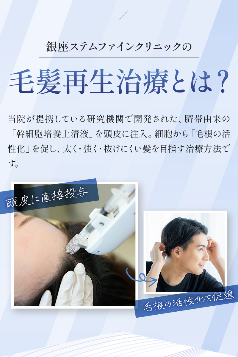 銀座ステムファインクリニックの毛髪再生治療とは？ 当院が提携している研究機関で開発された、臍帯由来の「幹細胞培養上清液」を頭皮に注入。細胞から「毛根の活性化」を促し、太く・強く・抜けにくい髪を目指す治療方法です。